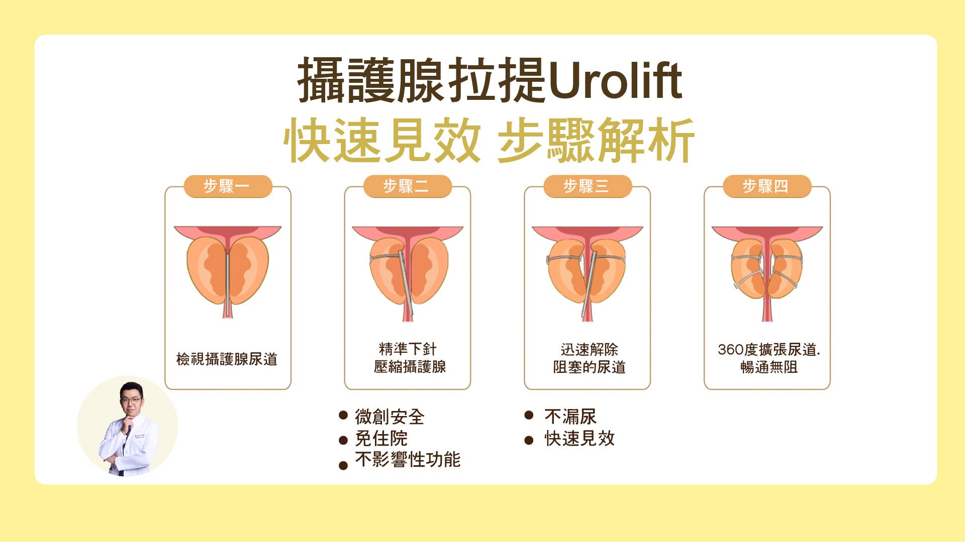 UroLift攝護腺拉提術是什麼?