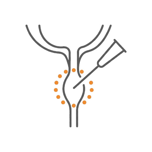 尿道注射Bulkamid