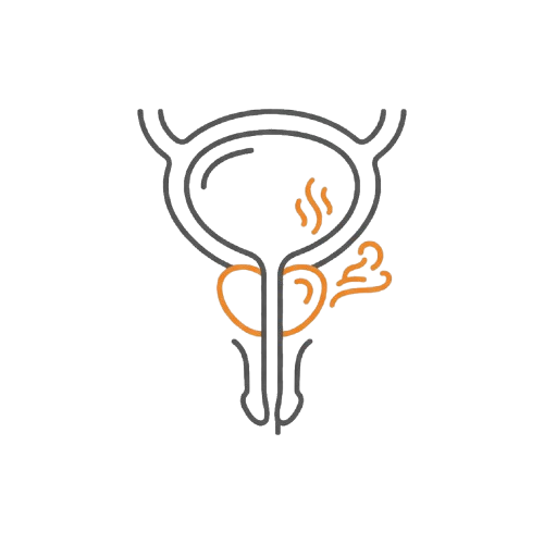 微創攝護腺水蒸氣縮小Rezum