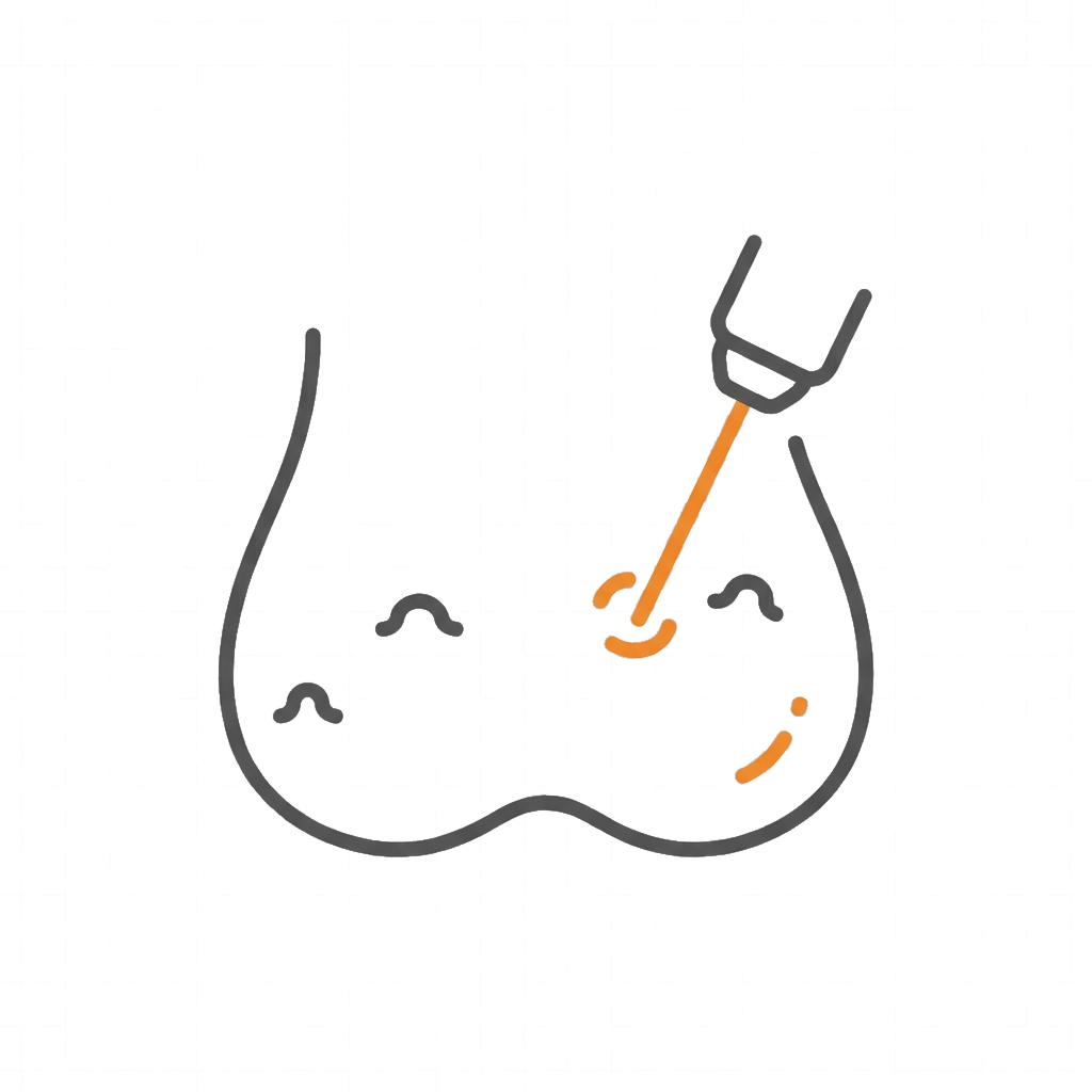 陰囊血管角化瘤雷射