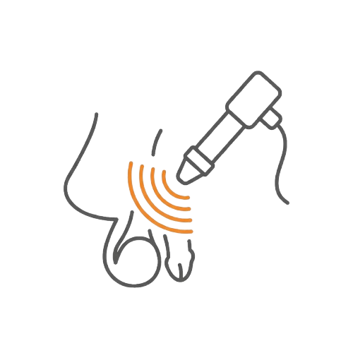 低能量震波(戴醫師親自治療)